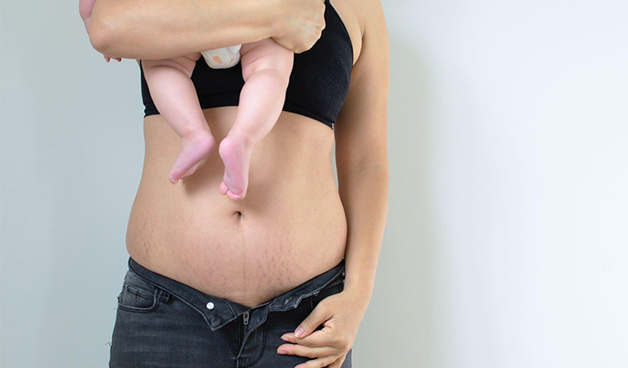 Физиологические причины набора веса у молодых мам